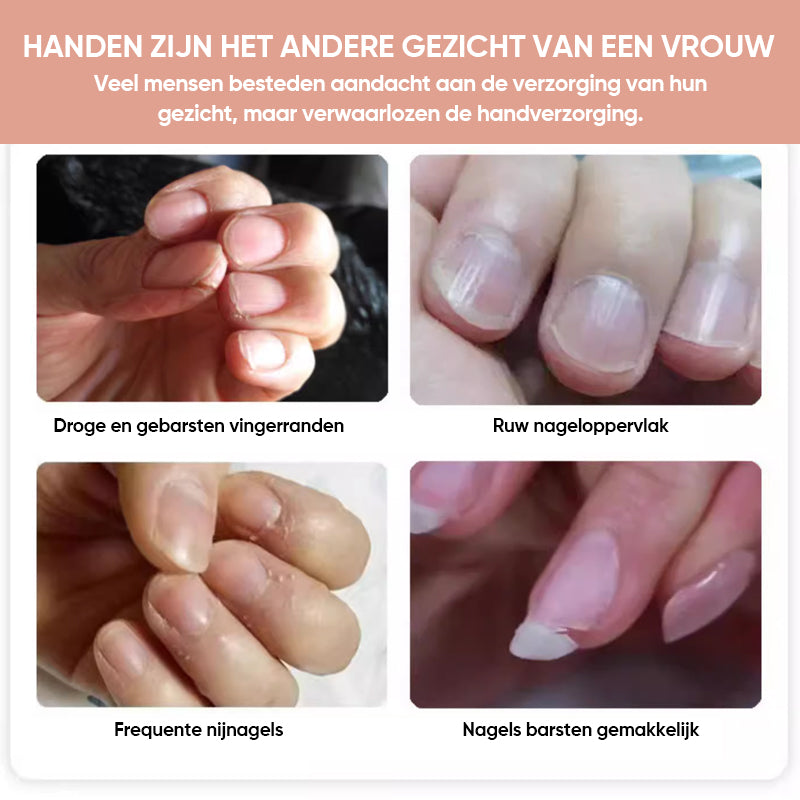 Voedingsgroeiolie voor nagels