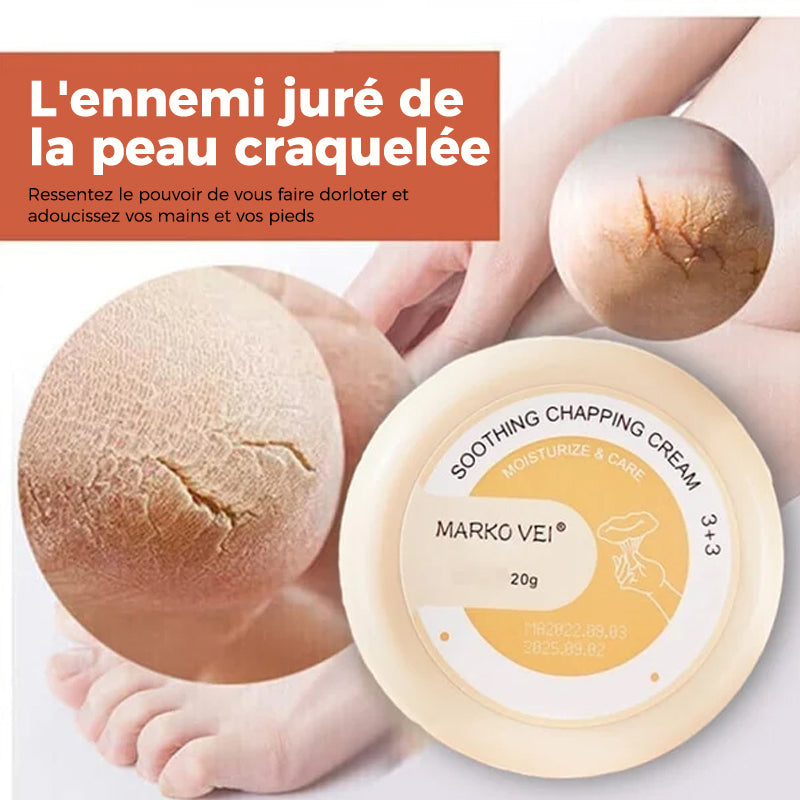 Crème anti-déchirure pour peau d'hiver